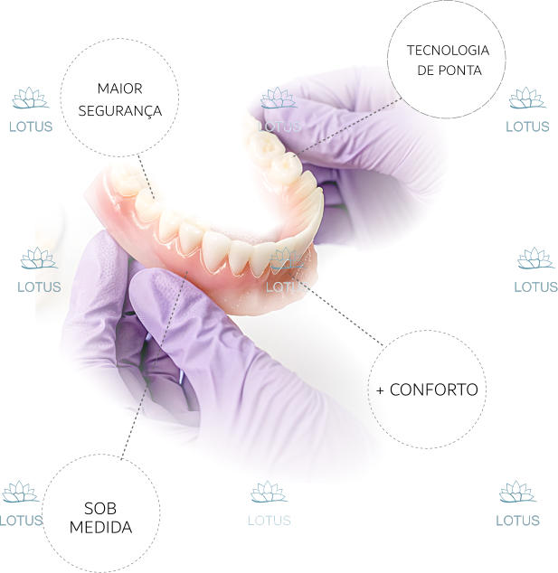 + CONFORTO MEDIDA SOB LOTUS LOTUS LOTUS LOTUS LOTUS LOTUS LOTUS LOTUS LOTUS DE PONTA TECNOLOGIA  MAIOR SEGURANÇA